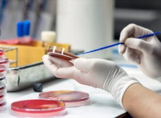 Κάθε χρόνο 120.000 ασθενείς προσβάλλονται από σήψη στην Ελλάδα
