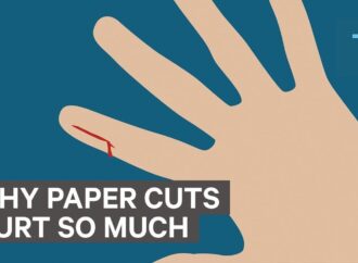 Viral: Γιατί πονάνε τόσο πολύ τα κοψίματα από χαρτί;
