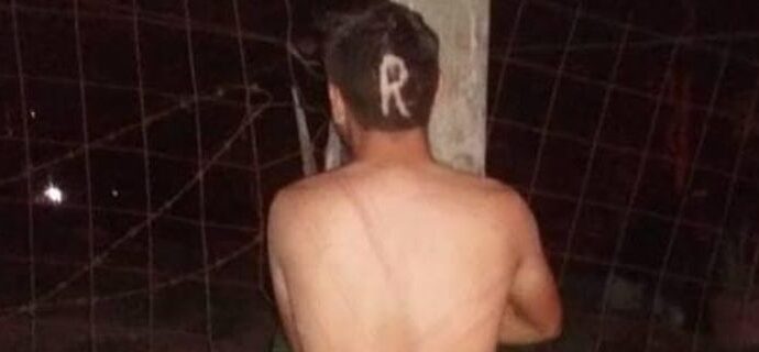 Απαγωγές-μυστήριο στο Μεξικό: Τα θύματα βρίσκονται γυμνά, δεμένα με χαραγμένο το κεφάλι τους [εικόνες]