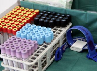 Ανοίγουν από σήμερα τα διαγνωστικά – Επί πληρωμή όλες οι εξετάσεις