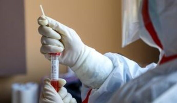 Ο συνδυασμός δύο μονοκλωνικών αντισωμάτων μείωσε κατά 70% τις νοσηλείες και τους θανάτους