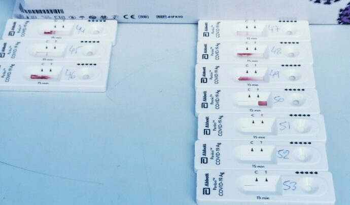Κορονοϊός-Ελλάδα: 2.435 κρούσματα, 817 διασωληνωμένοι, 73 θάνατοι