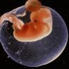 Η τροποποίηση ανθρώπινου εμβρυϊκού DNA είναι γεγονός