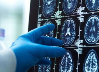 Παγκόσμια πρωτιά: Επιτυχημένη αφαίρεση εγκεφαλικού όγκου με υποβοήθηση Τεχνητής Νοημοσύνης