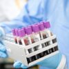 Καφεΐνη: πόση θεωρείται πολλή και πώς επηρεάζει τον ύπνο