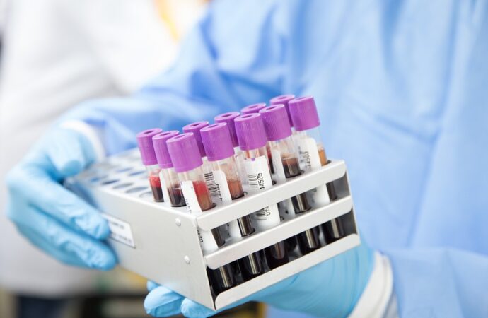 Καφεΐνη: πόση θεωρείται πολλή και πώς επηρεάζει τον ύπνο