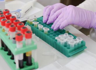 Αρτηριακή πίεση: πώς μετριέται σωστά στο σπίτι
