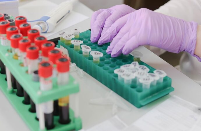Αρτηριακή πίεση: πώς μετριέται σωστά στο σπίτι