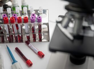 Εποχική γρίπη και κρυολόγημα: πώς ξεχωρίζουν