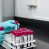 Γλουτένη: ποιοι πρέπει πραγματικά να την αποφεύγουν