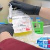 Αιματολόγοι προειδοποιούν: Επικίνδυνες οι μη τεκμηριωμένες αναγεννητικές θεραπείες