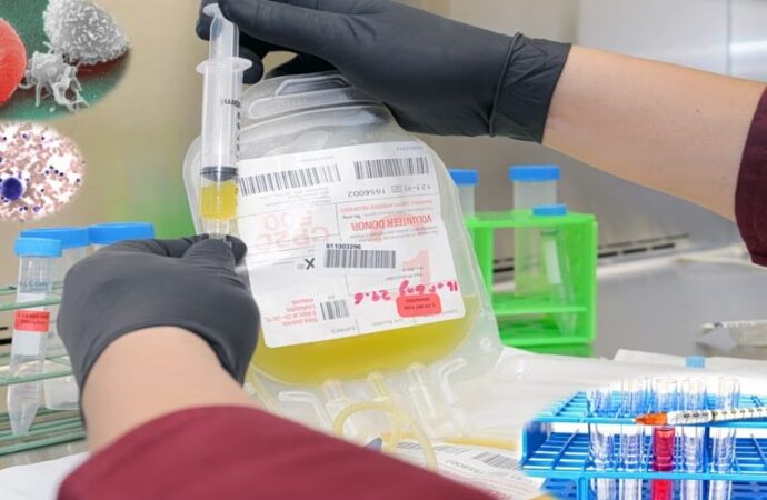 Αιματολόγοι προειδοποιούν: Επικίνδυνες οι μη τεκμηριωμένες αναγεννητικές θεραπείες