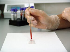 Μετανάστευση πουλιών: πώς προσανατολίζονται