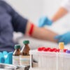 Πρέπει να διακόπτουμε τη νηστεία πριν από τις αιματολογικές εξετάσεις; Τι δείχνει νέα έρευνα