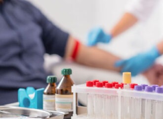 Πρέπει να διακόπτουμε τη νηστεία πριν από τις αιματολογικές εξετάσεις; Τι δείχνει νέα έρευνα