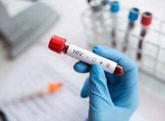 Επιστήμονες μαθαίνουν να ελέγχουν τον HIV χωρίς φάρμακα: Νέα ελπίδα στην αντιμετώπιση του AIDS