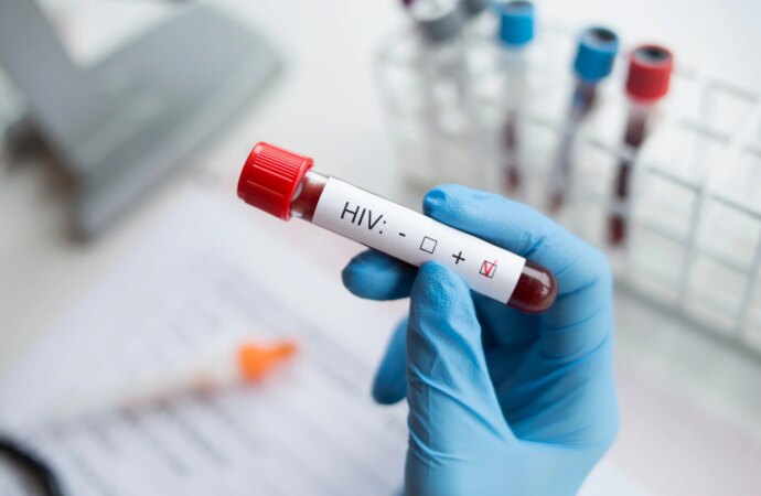 Επιστήμονες μαθαίνουν να ελέγχουν τον HIV χωρίς φάρμακα: Νέα ελπίδα στην αντιμετώπιση του AIDS