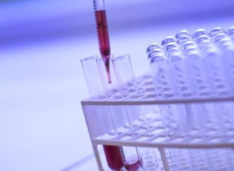 Πώς προβλέπεται ο καιρός και γιατί κάνει λάθη
